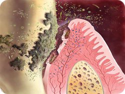 Koruyucu Diş Tedavisi Ağızda Başlar