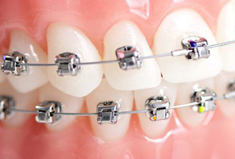 İleri Ortodonti Kursu