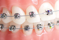 İleri Ortodonti Kursu